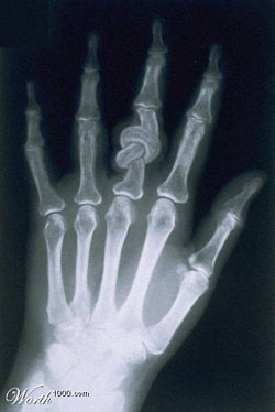 Penglihatan X-ray